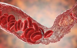 वैज्ञानिकहरूद्वारा ‘क्लटिङ क्लटिङ’ को समस्या समाधान, खुल्यो सुरक्षित खोप बनाउन बाटो