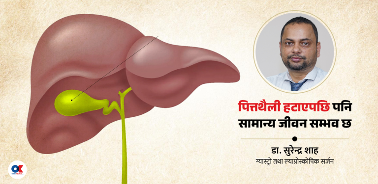 किन हुन्छ पित्तथैलीमा पत्थरी ? के  शल्यक्रियाबिना उपचार सम्भव छ ?