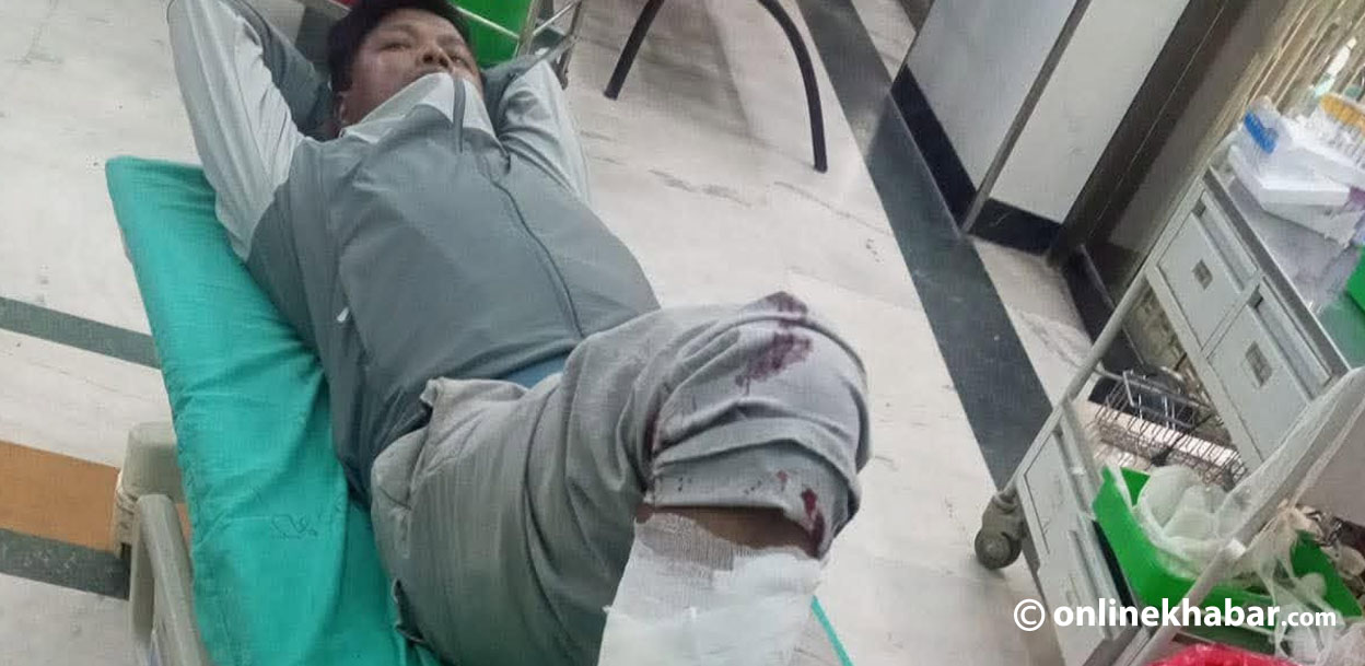 ३ वर्ष जेल बसेर ६ महिनाअघि छुटेका व्यक्ति फेरि लागूऔषध कारोबारमै, प्रहरीले गोली चलाएर समात्यो