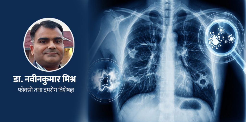ब्रोंकाइटिस र निमोनिया, यी दुईमा के फरक छ ?