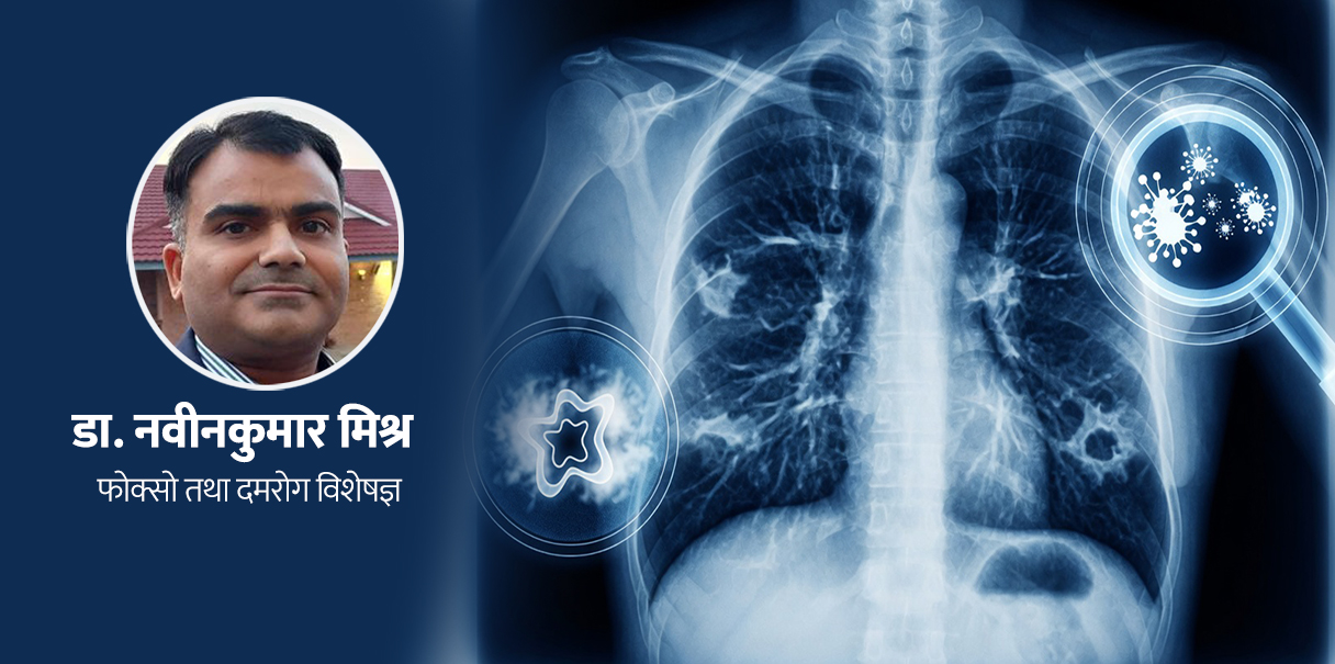 ब्रोंकाइटिस र निमोनिया, यी दुईमा के फरक छ ?
