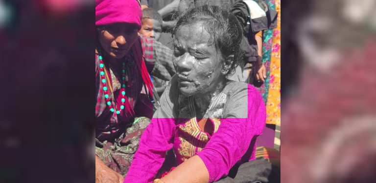 रोल्पामा प्रेसर कुकर फड्किँदा एक जना घाइते