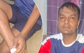 लहानमा ड्युटीमा रहेका प्रहरी हवलदार घाइते