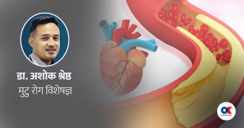 हृदय समस्या : ट्राइग्लिसराइड र कोलेस्टेरोल एउटै हो ?