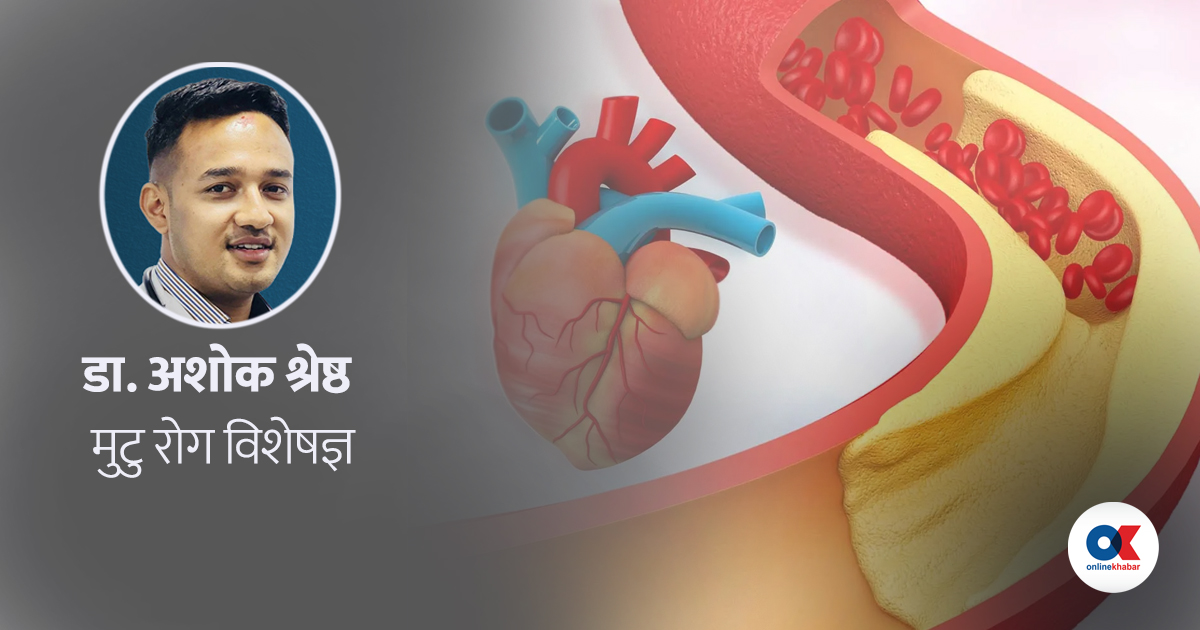 मुटु स्वास्थ्य : ट्राइग्लिसराइड र कोलेस्टेरोल एउटै हो ?