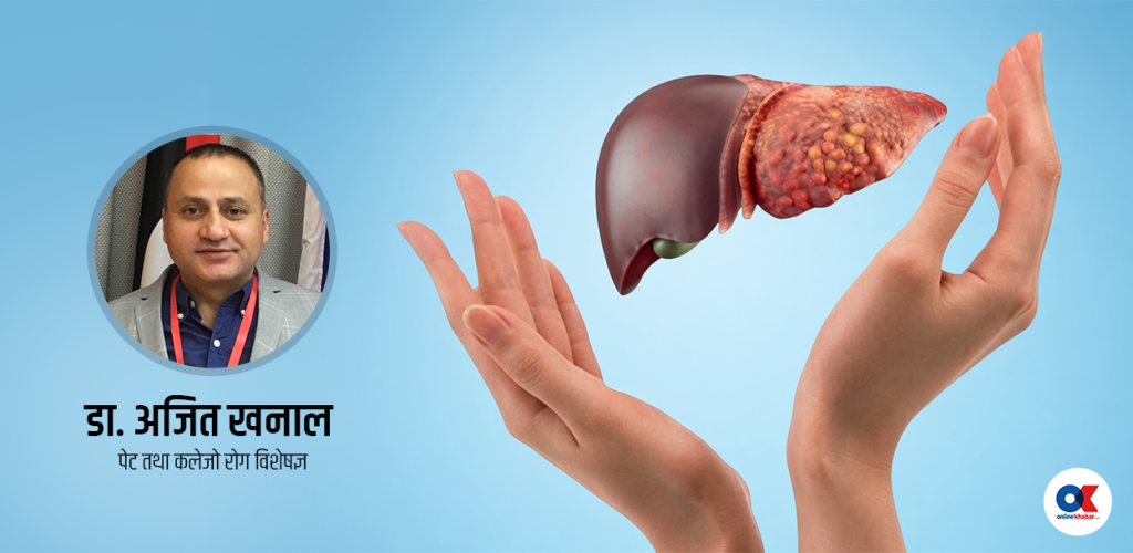कति खतरनाक हो फ्याटी लिभर ‍? नियन्त्रणका ५ तरिका
