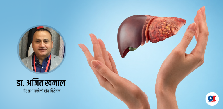 कति खतरनाक हो फ्याटी लिभर ‍? नियन्त्रणका ५ तरिका