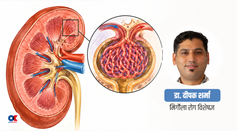 मिर्गौलाको ‘फिल्टर’ बिग्रने रोग : के हो ग्लोमेरुलोनेफ्राइटिस र आईजीए नेफ्रोप्याथी ?