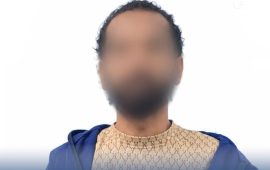 वृद्धाको घाँटीमा लगाएको तिलहरी लुटपाट गर्ने व्यक्ति पक्राउ